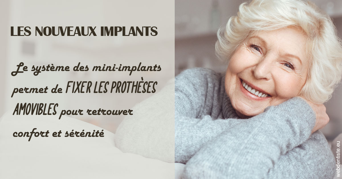 https://dr-medioni-philippe.chirurgiens-dentistes.fr/Les nouveaux implants 1