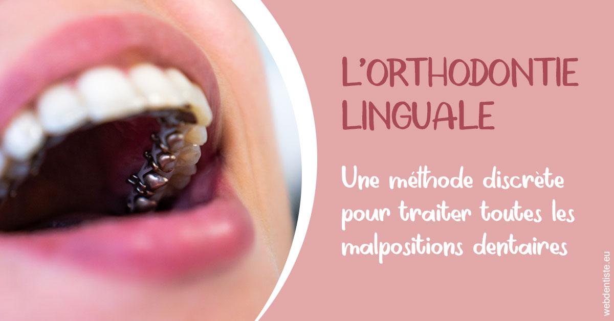 https://dr-medioni-philippe.chirurgiens-dentistes.fr/L'orthodontie linguale 2
