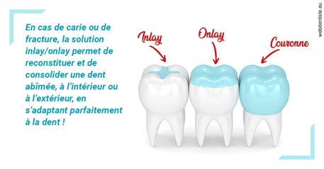 https://dr-medioni-philippe.chirurgiens-dentistes.fr/L'INLAY ou l'ONLAY