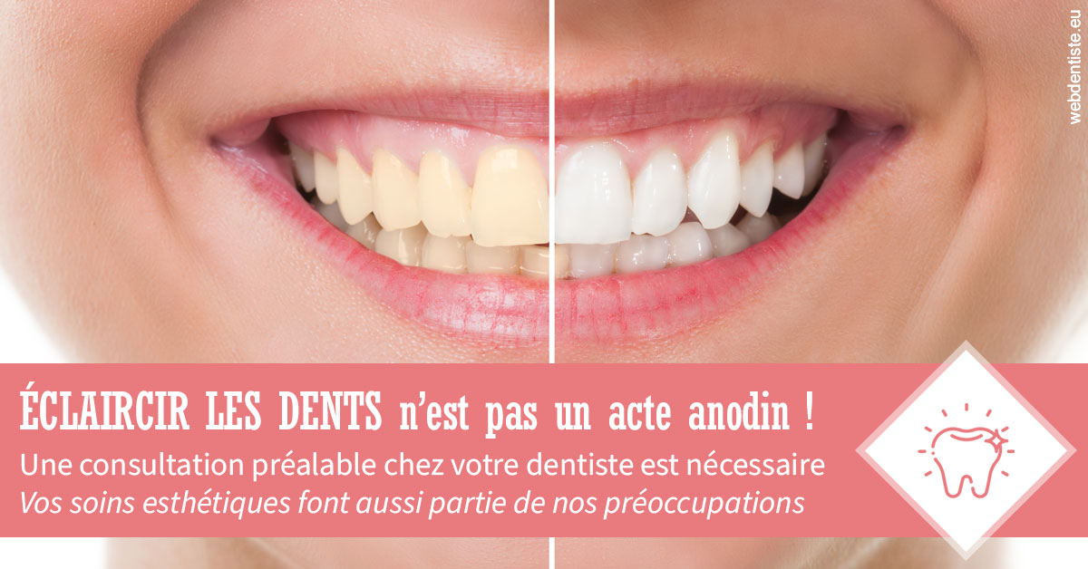 https://dr-medioni-philippe.chirurgiens-dentistes.fr/Eclaircir les dents 1