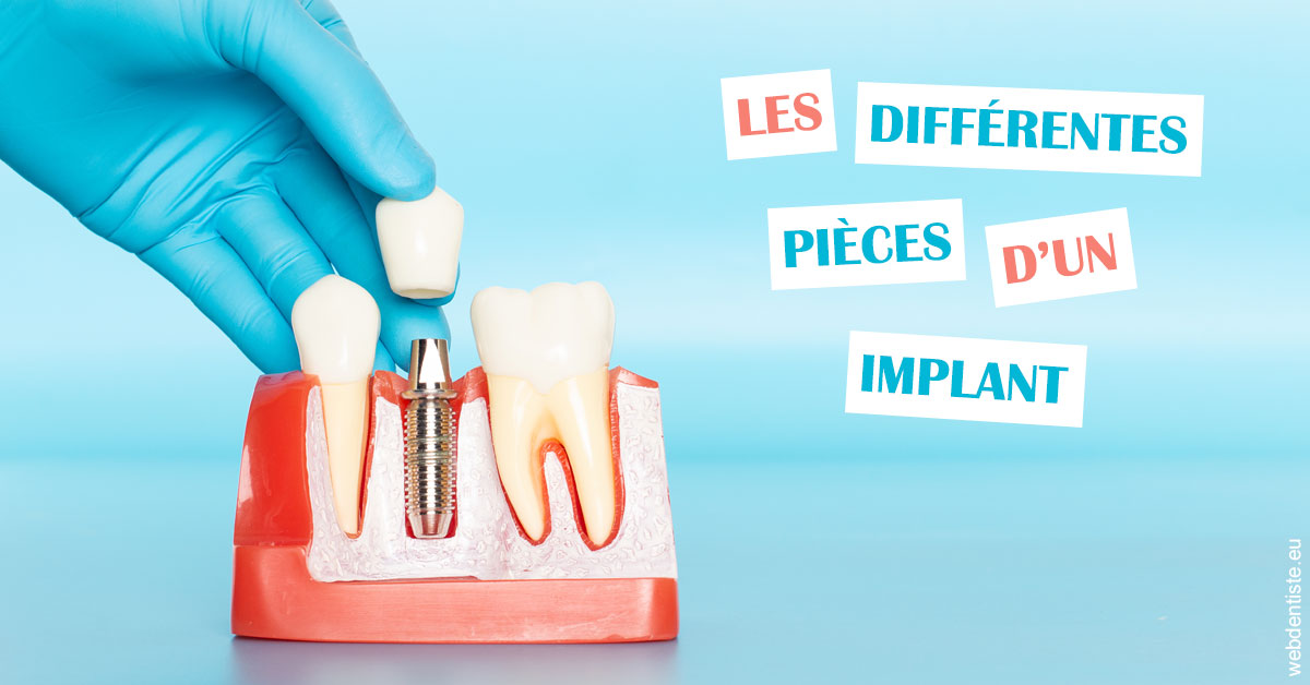 https://dr-medioni-philippe.chirurgiens-dentistes.fr/Les différentes pièces d’un implant 2
