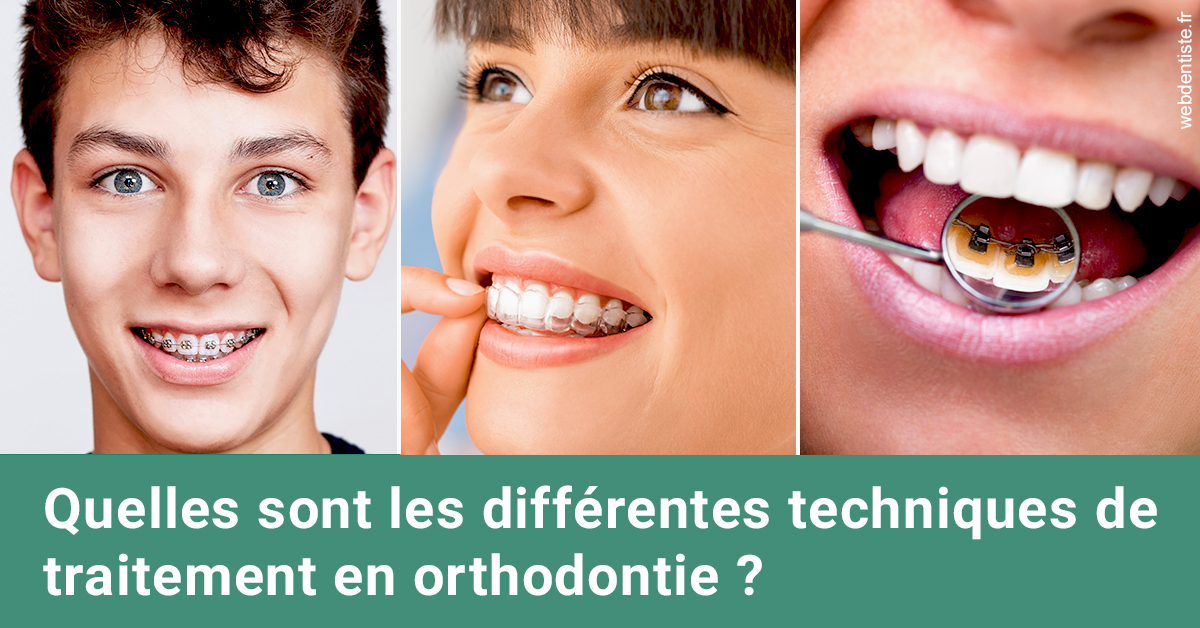 https://dr-medioni-philippe.chirurgiens-dentistes.fr/Les différentes techniques de traitement 2