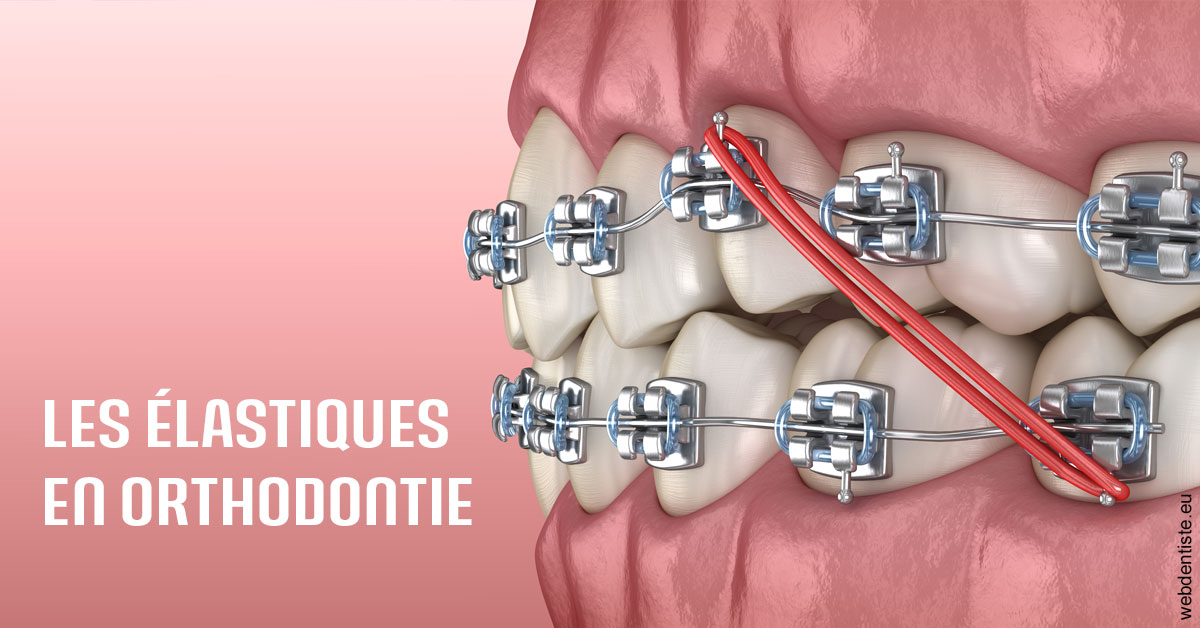 https://dr-medioni-philippe.chirurgiens-dentistes.fr/Elastiques orthodontie 2