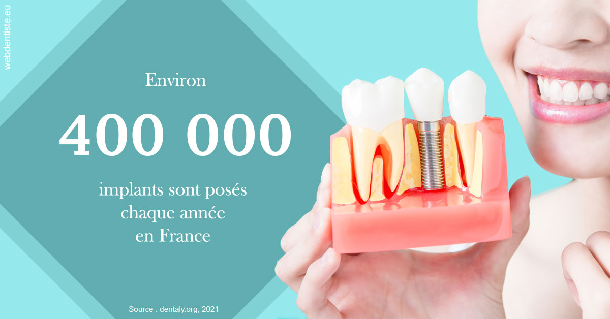 https://dr-medioni-philippe.chirurgiens-dentistes.fr/Pose d'implants en France 2