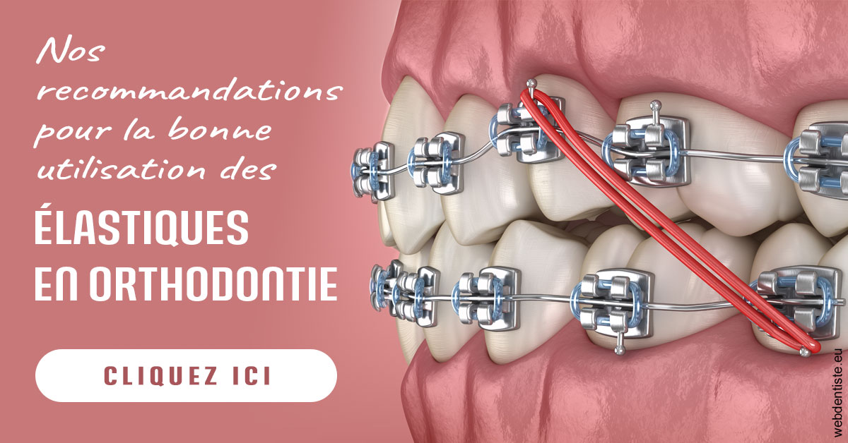 https://dr-medioni-philippe.chirurgiens-dentistes.fr/Elastiques orthodontie 2